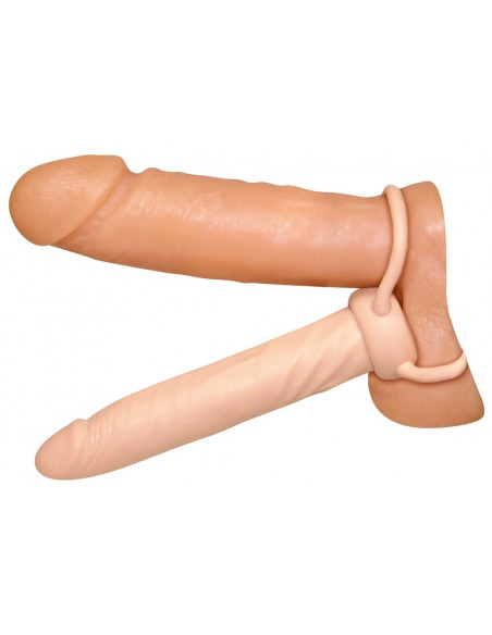 Anal Special nature