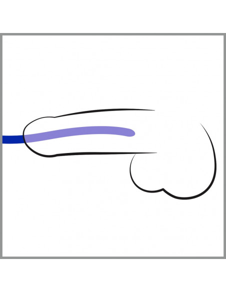 Silicone Dilator Set - You2Toys - blu
